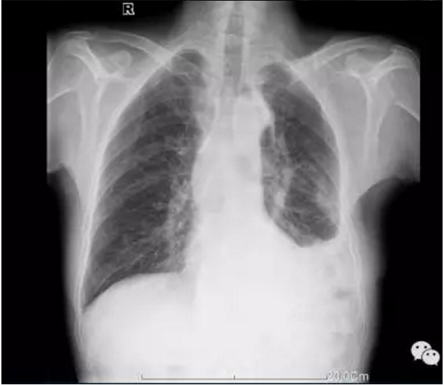 1574735814348922.png image.png