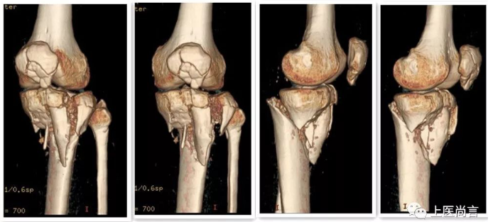 1575363914850755.png image.png