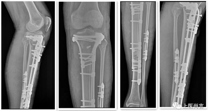 1575363949610020.png image.png